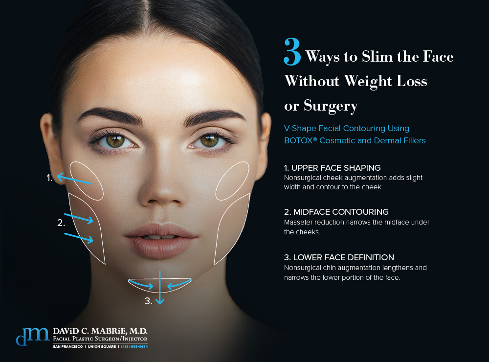 Facial sculpting surgery