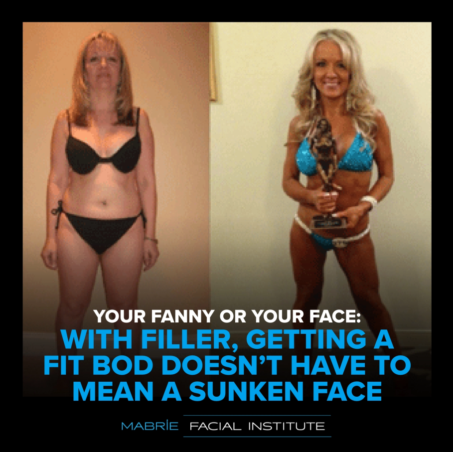 Woman's body before and after increased fitness and facial fillers