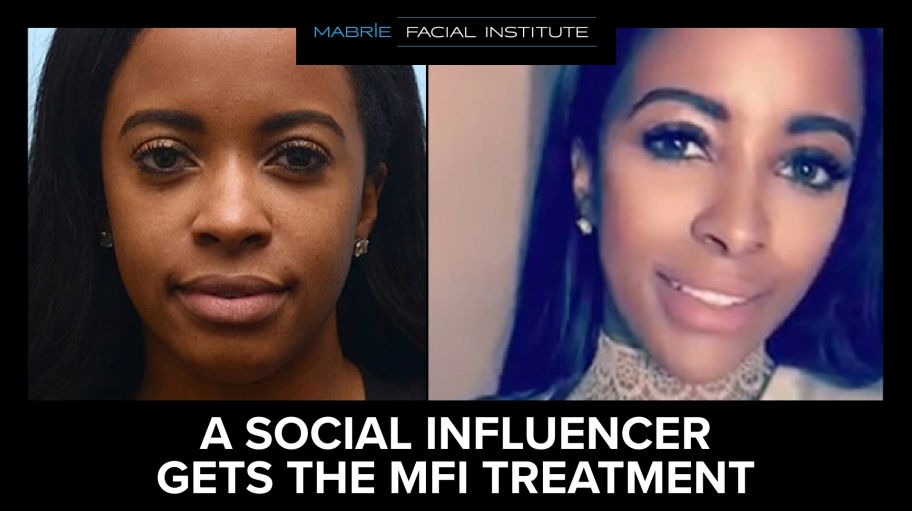A woman influencer's smiling face before and after treatment