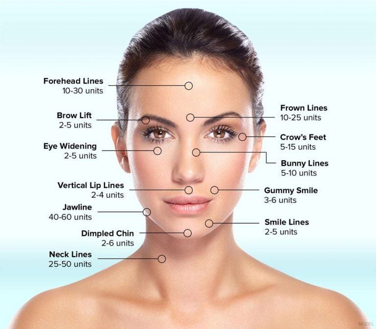 BOTOX in the San Francisco Bay Area