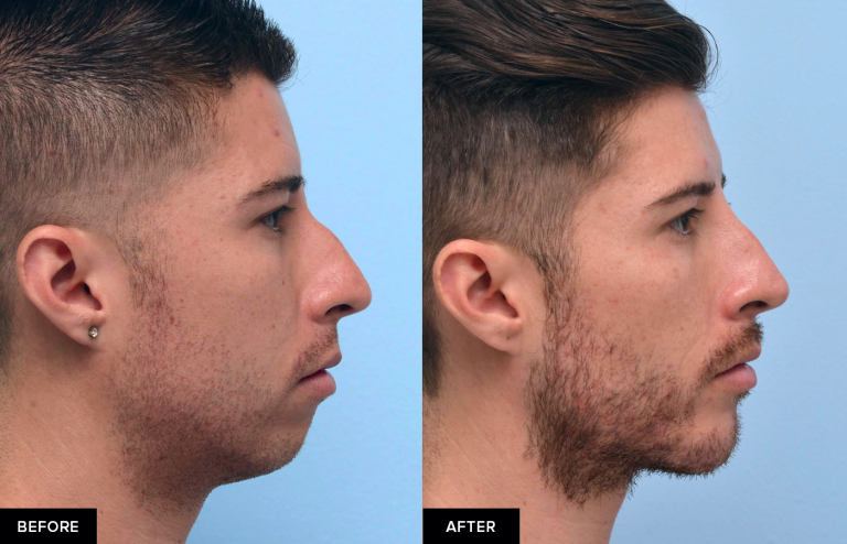 Bone Structure: How to Enhance Your Jawline - wide 5