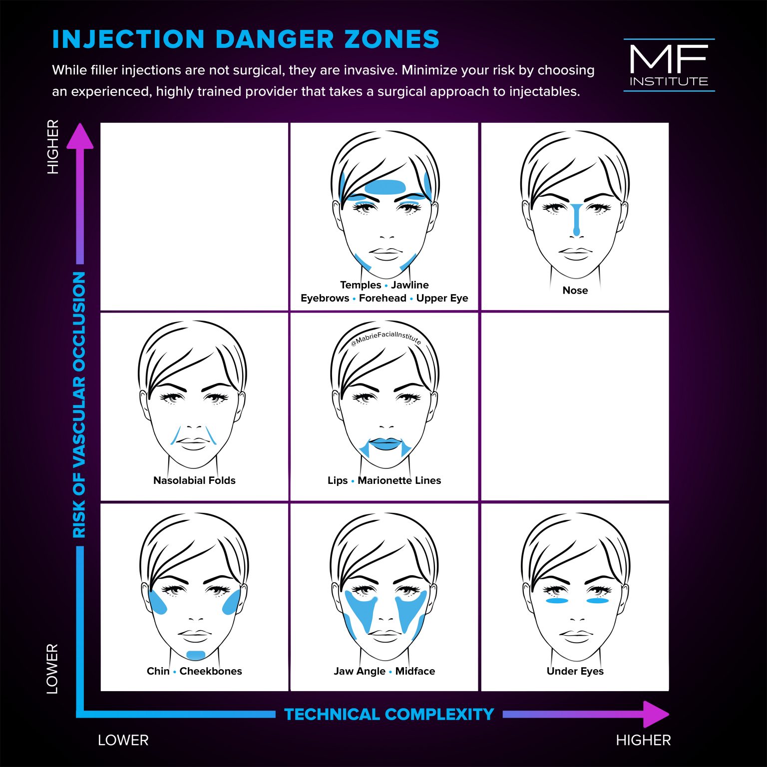 choosing-an-expert-injector-in-san-francisco-mabrie-facial-institute