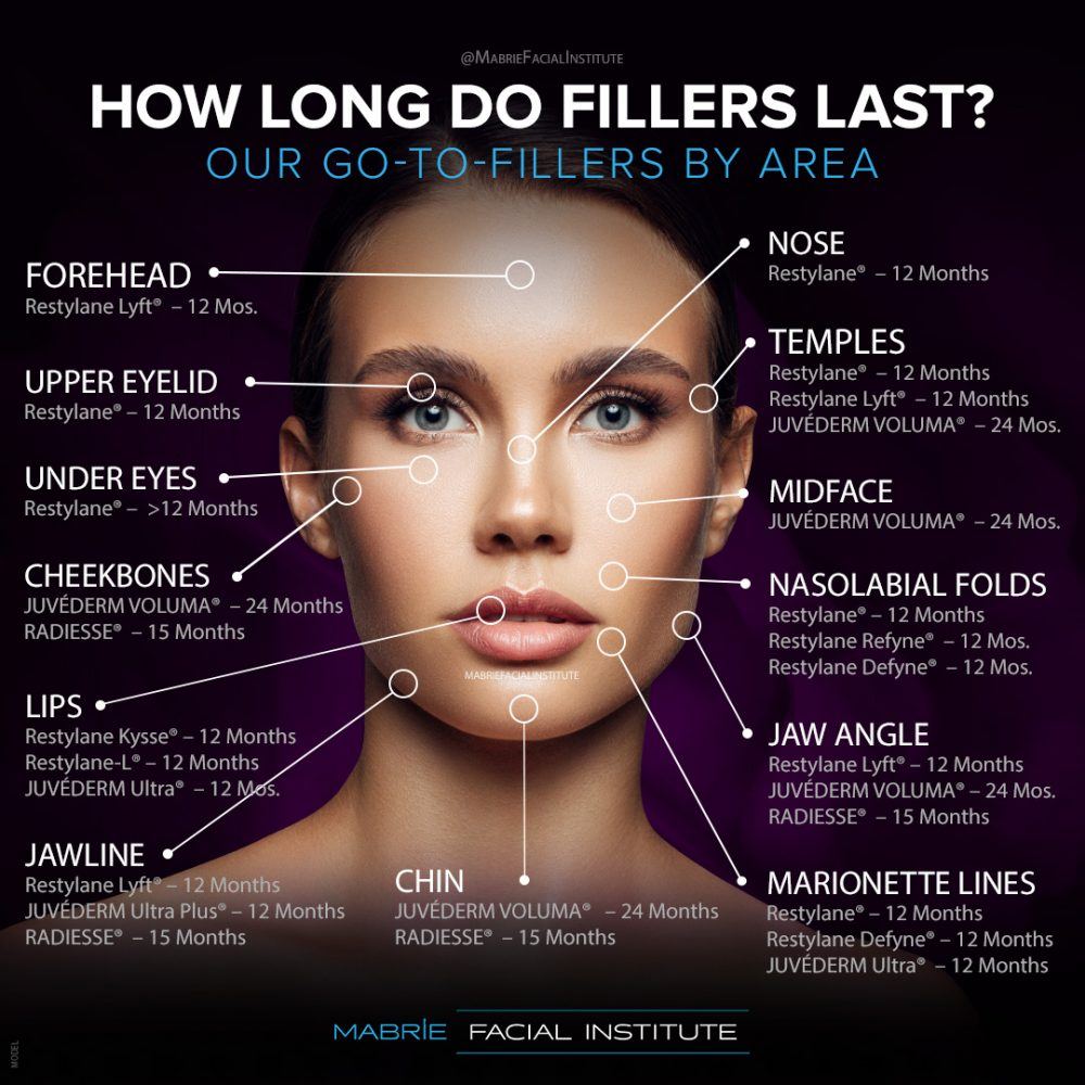 What Are Dermal Fillers KihNow