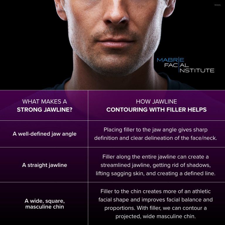 Jawline Filler For Men Transformative Before And After Photos Mabrie