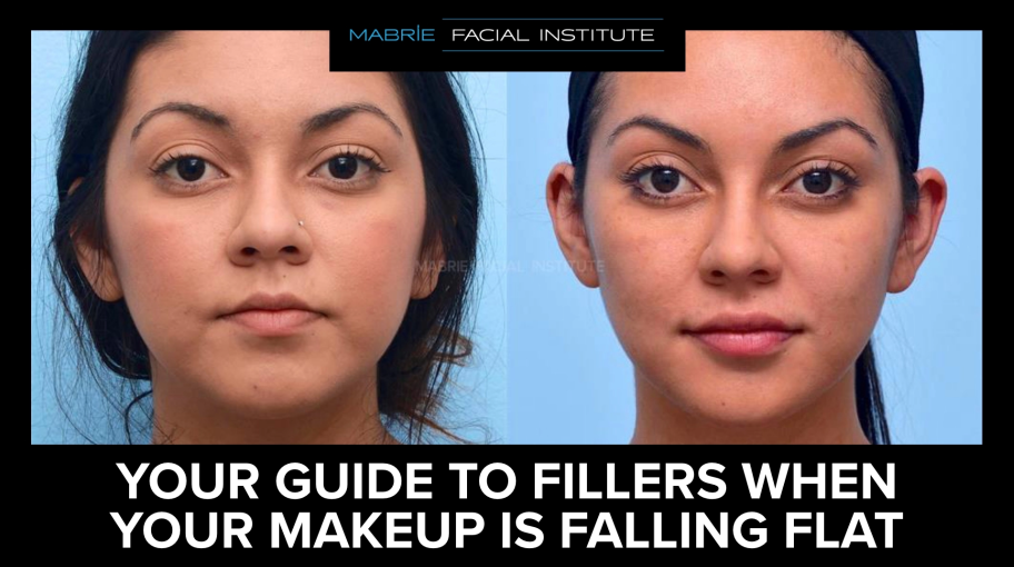 Before and after full face treatment and text that reads, "your guide to fillers when your relationship is falling flat"