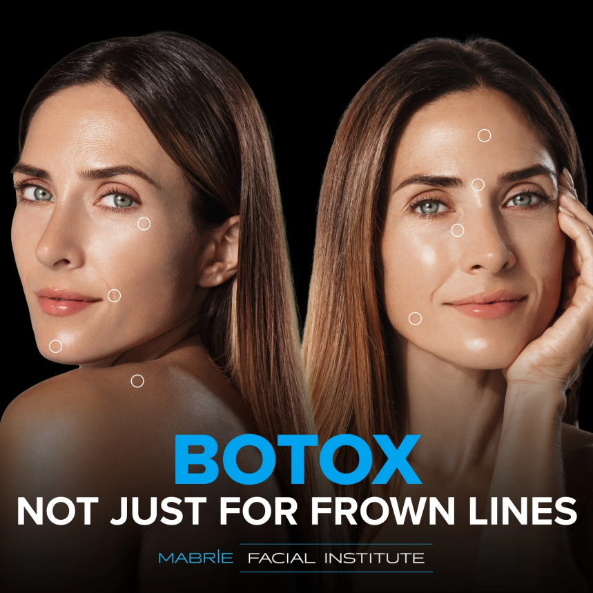 Two woman smiling with text that reads "BOTOX® Not just for frown lines "