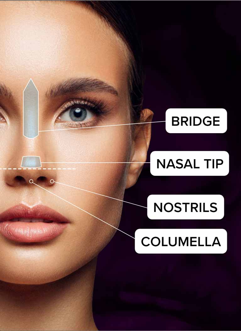 Diagram of Rhinoplasty treatment areas on a woman's face.