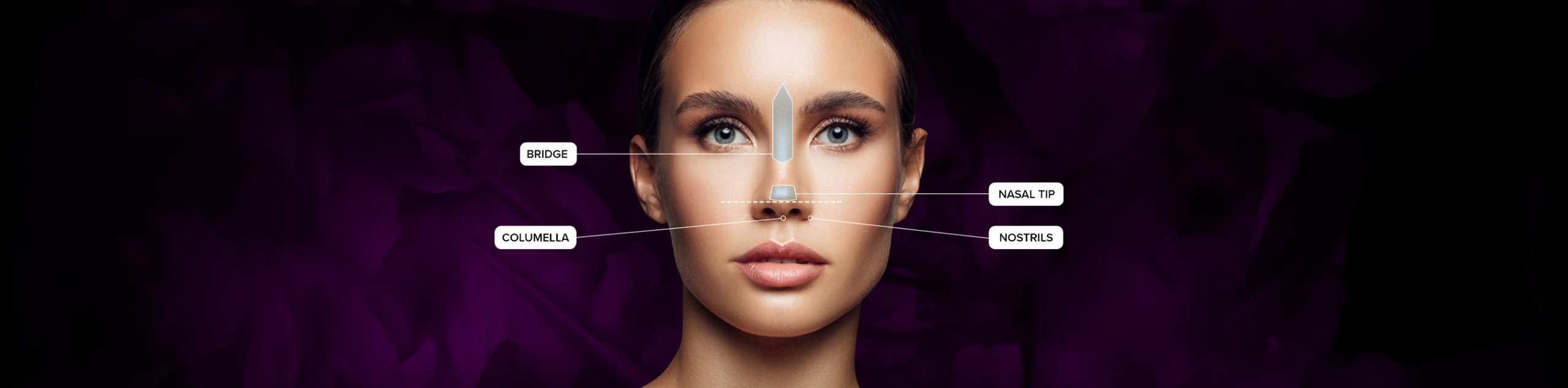 Diagram of Rhinoplasty treatment areas on a woman's face.