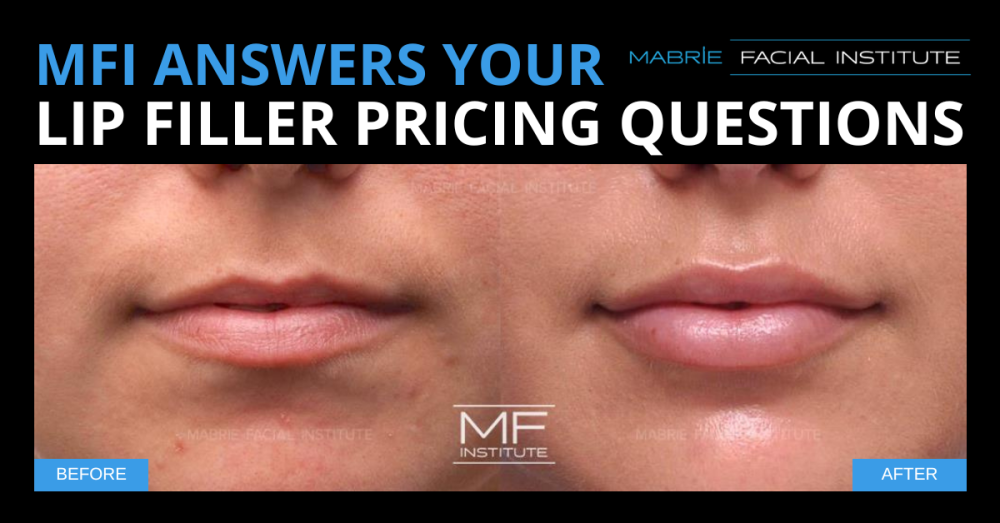 Lip filler before and after photos with text that reads ' MFI Answers Your Lip Filler Pricing Questions'