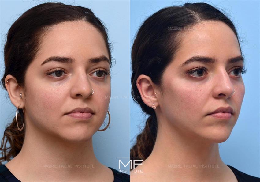 Before & After contouring for Layering Did This face shape
