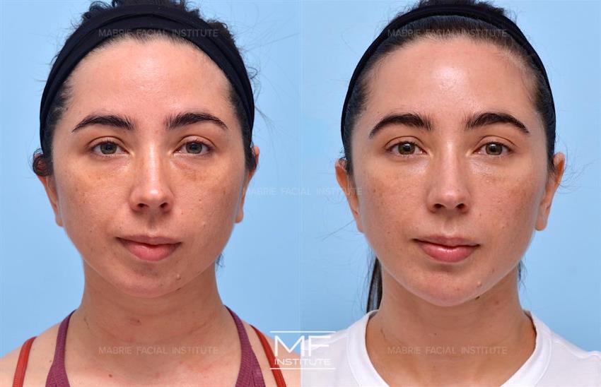 Before & After contouring for strong face shape